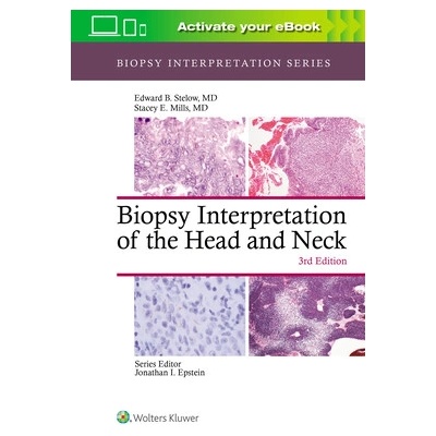 Biopsy Interpretation of the Head and Neck