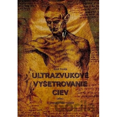 Ultrazvukové vyšetrenie ciev 2. prepracované vydanie