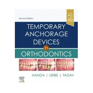 Temporary Anchorage Devices in Orthodontics | Ravindra Nanda, Flavio Andres Uribe, Sumit Yadav (ISBN: 9780323609333)