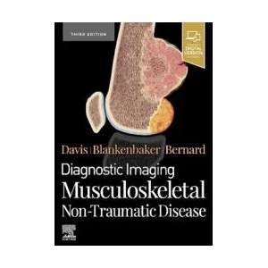 Diagnostic Imaging: Musculoskeletal Non-Traumatic Disease | Kirkland W. Davis, Donna Blankenbaker, Stephanie A Bernard (ISBN: 9780323834735)