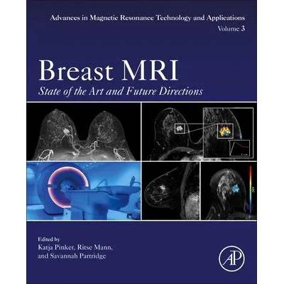 Breast MRI | Katja Pinker-Domenig, Ritse Mann, Savannah Partridge