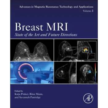 Image 1 of Breast MRI | Katja Pinker-Domenig, Ritse Mann, Savannah Partridge