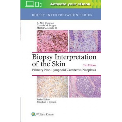 Biopsy Interpretation of the Skin - Primary Non-Lymphoid Cutaneous NeoplasiaPevná vazba