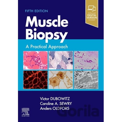 Muscle Biopsy - Victor Dubowitz Caroline Sewry Anders Oldfors