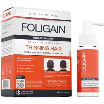 FOLIGAIN Triple Action Complete Formula For Thinning Hair For Men 10% Trioxidil 59 ml