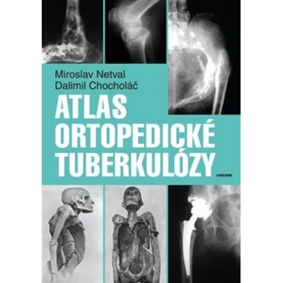 Atlas ortopedické tuberkulózy - Miroslav Netval