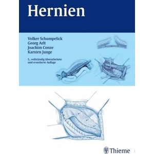 Hernien | Volker Schumpelick, Hermann van Ackeren, Uwe Klinge (ISBN: 9783131173652)