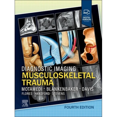 Diagnostic Imaging: Musculoskeletal Trauma