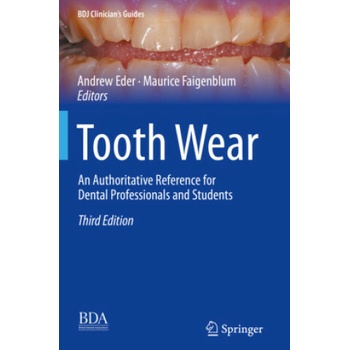 Tooth Wear