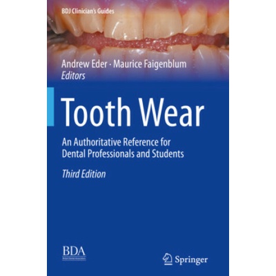 Tooth Wear