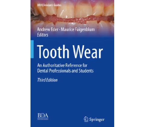 Tooth Wear