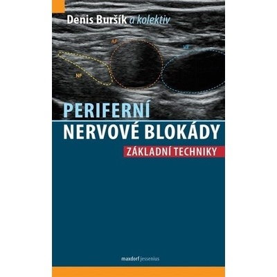 Periferní nervové blokády