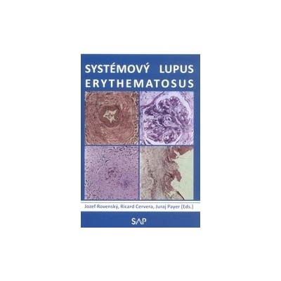 Systémový lupus erythematosus