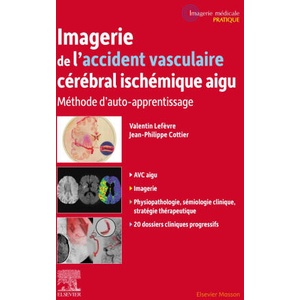 Imagerie de l'accident vasculaire cérébral ischémique aigu | Valentin LEFEVRE, Professeur Jean-Philippe Cottier (2025)
