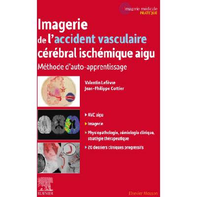 Imagerie de l'accident vasculaire cérébral ischémique aigu | Valentin LEFEVRE, Professeur Jean-Philippe Cottier