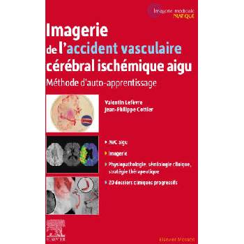 Image 1 of Imagerie de l'accident vasculaire cérébral ischémique aigu | Valentin LEFEVRE, Professeur Jean-Philippe Cottier
