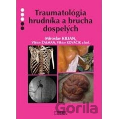 Traumatológia hrudníka a brucha dospelých - Miroslav Kilian, Viktor Žalman, Viktor Kováčik