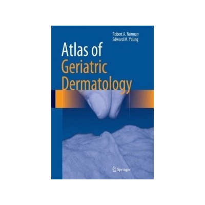 Atlas of Geriatric Dermatology