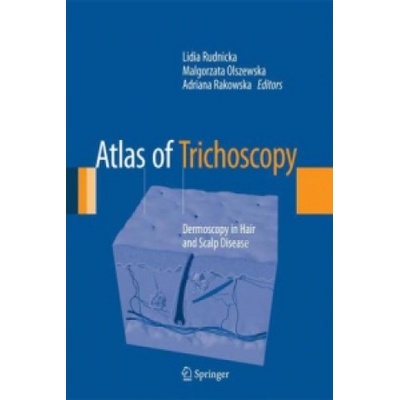 Atlas of Trichoscopy Rudnicka Lidia