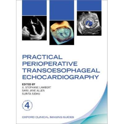 Practical Perioperative Transoesophageal Echocardiography | Sara Jane Allen, Surita Sidhu