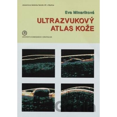 Ultrazvukový atlas kože - Eva Mináriková