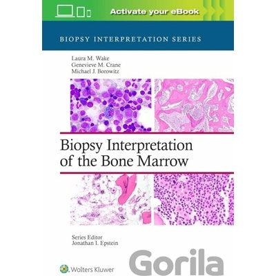 Biopsy Interpretation of the Bone Marrow - Genevieve M. Crane, Laura M. Wake, Michael J. Borowitz