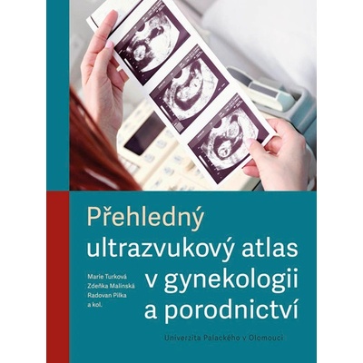 Přehledný ultrazvukový atlas v gynekologii a porodnictví - Marie Turková; Zdeňka Malínská; Radovan Pilka; kol