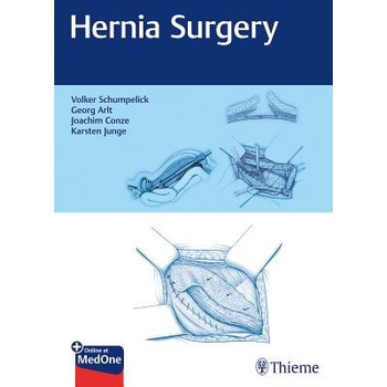 Hernia SurgeryPevná vazba