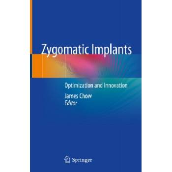 Zygomatic Implants | James Chow