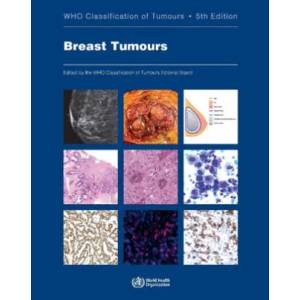 Breast Tumours: Who Classification of Tumours (ISBN: 9789283245001)