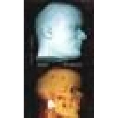 Som Ťukot