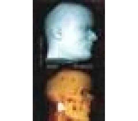Som Ťukot