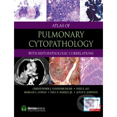 Atlas of Pulmonary Cytopathology Vandenbussche Christopher J.Pevná vazba