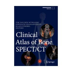 Clinical Atlas of Bone SPECT/CT | Klaus Strobel, Gopinath Gnanasegaran (ISBN: 9783031264481)