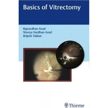 Basics of Vitrectomy