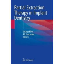 Partial Extraction Therapy in Implant Dentistry