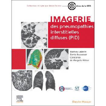 Imagerie des pneumopathies interstitielles diffuses (PID) | Professeur Mathieu Lederlin