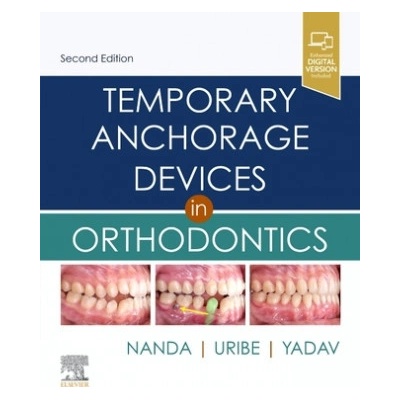 Temporary Anchorage Devices in Orthodontics