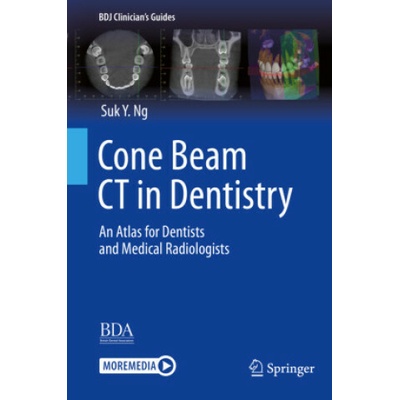Cone Beam CT in Dentistry
