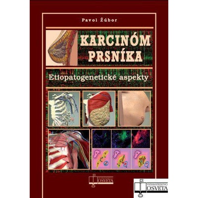 Karcinóm prsníka - Etiopatogenetické aspekty - Žúbor Pavol