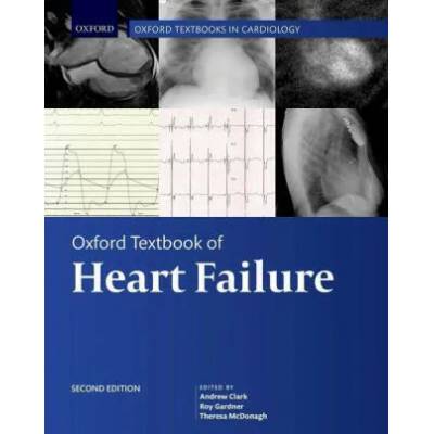 Oxford Textbook of Heart Failure | THERESA MCDONAGH