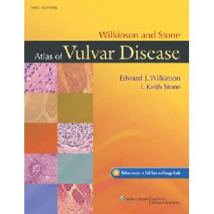 Wilkinson and Stone Atlas of Vulvar Disease | Edward Wilkinson (ISBN: 9781451132182)