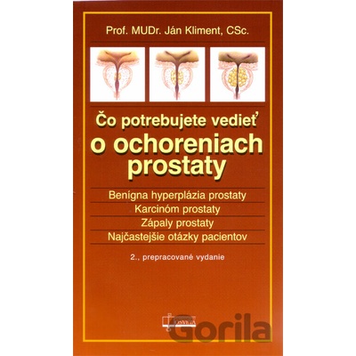 Čo potrebujete vedieť o ochreniach prostaty 2.vydanie - Ján Kliment