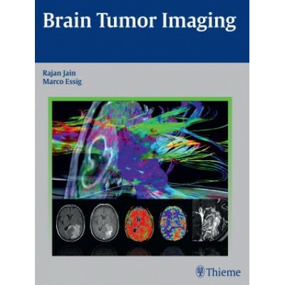 Brain Tumor Imaging Jain RajanPevná vazba