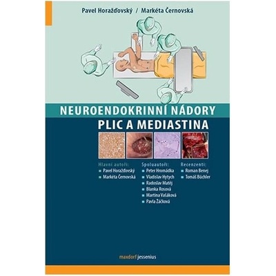 Neuroendokrinní nádory plic a mediastina - Pavel Horažďovský, Markéta Černovská