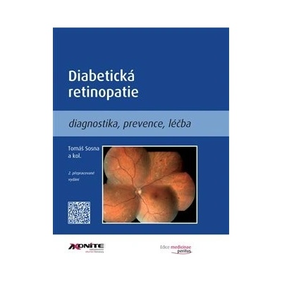 Diabetická retinopatie - Tomáš Sosna, kol.