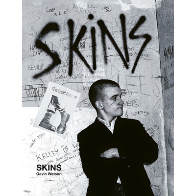 Skins: Gavin Watson Watson Gavin