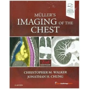 Muller's Imaging of the Chest | Christopher Walker (ISBN: 9780323462259)