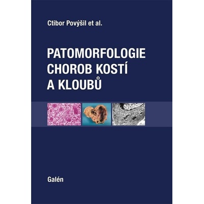 Patomorfologie chorob kostí a kloubů