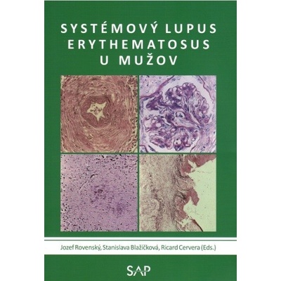 Systemovy lupus erythematosus u muzov